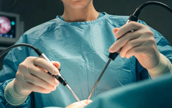 chirurgia-endoscopica-colon