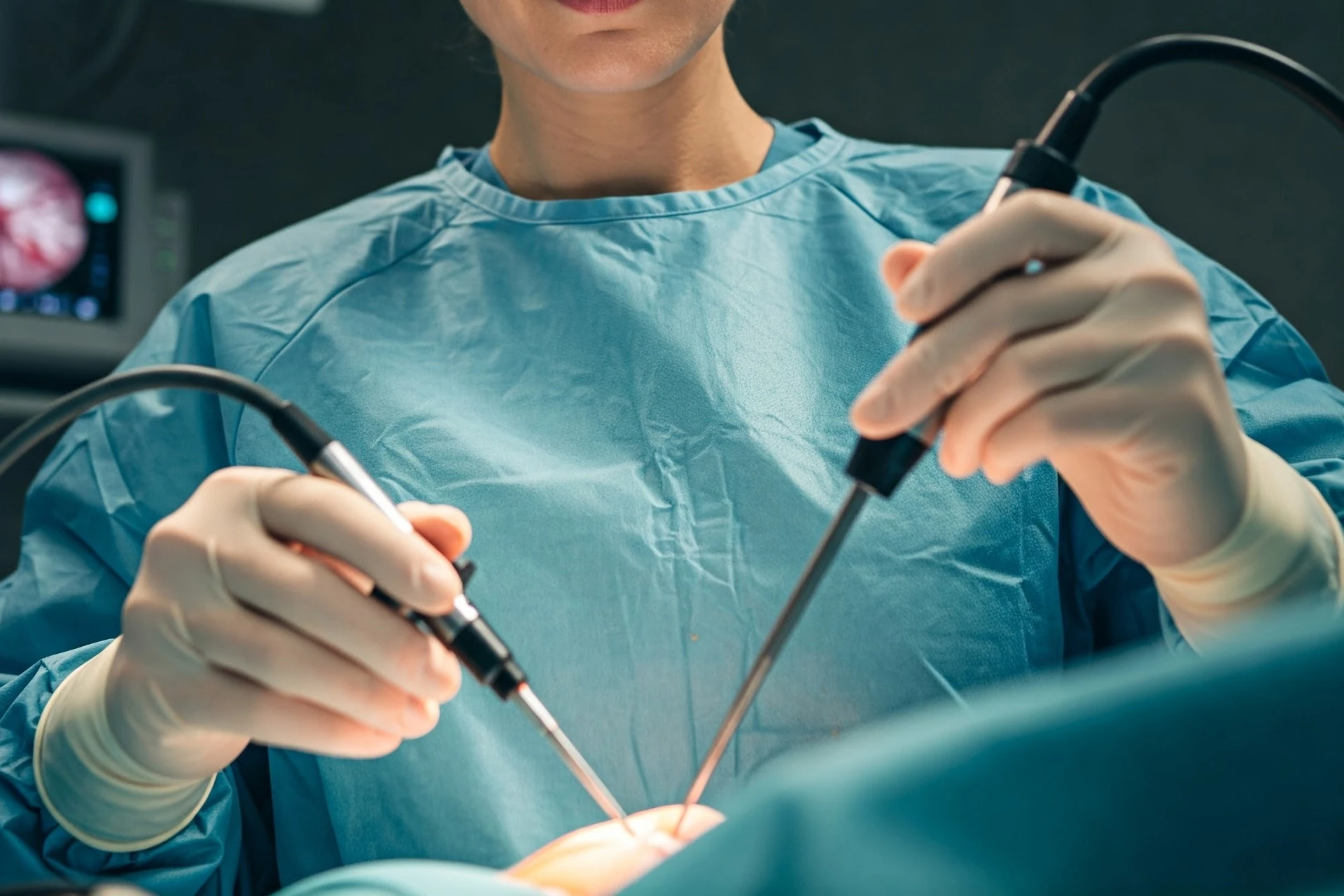 chirurgia-endoscopica-colon